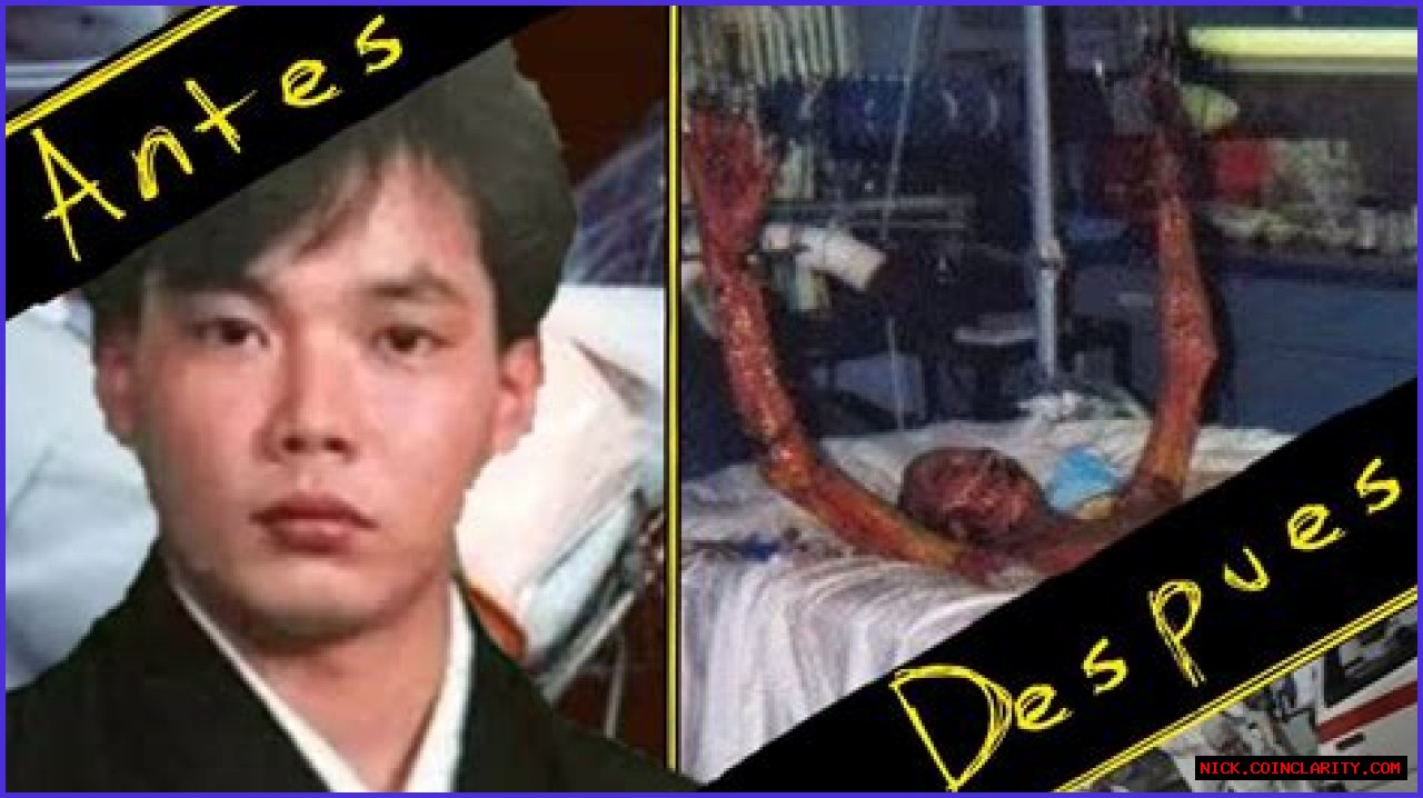 Hisashi Ouchi: The Real Picture Behind The Tragedy